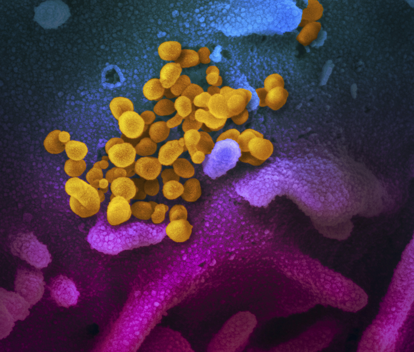 Coronavirus, nuove immagini al microscopio (LaPresse)