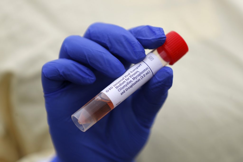 Coronavirus analisi