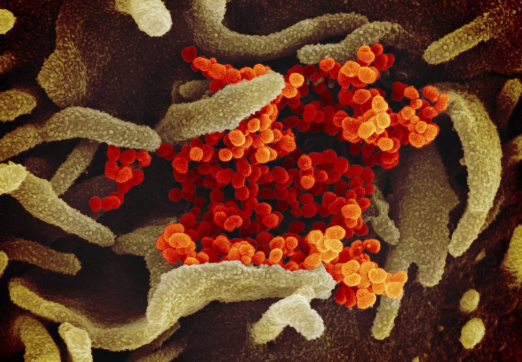 Coronavirus, nuove immagini al microscopio (LaPresse)