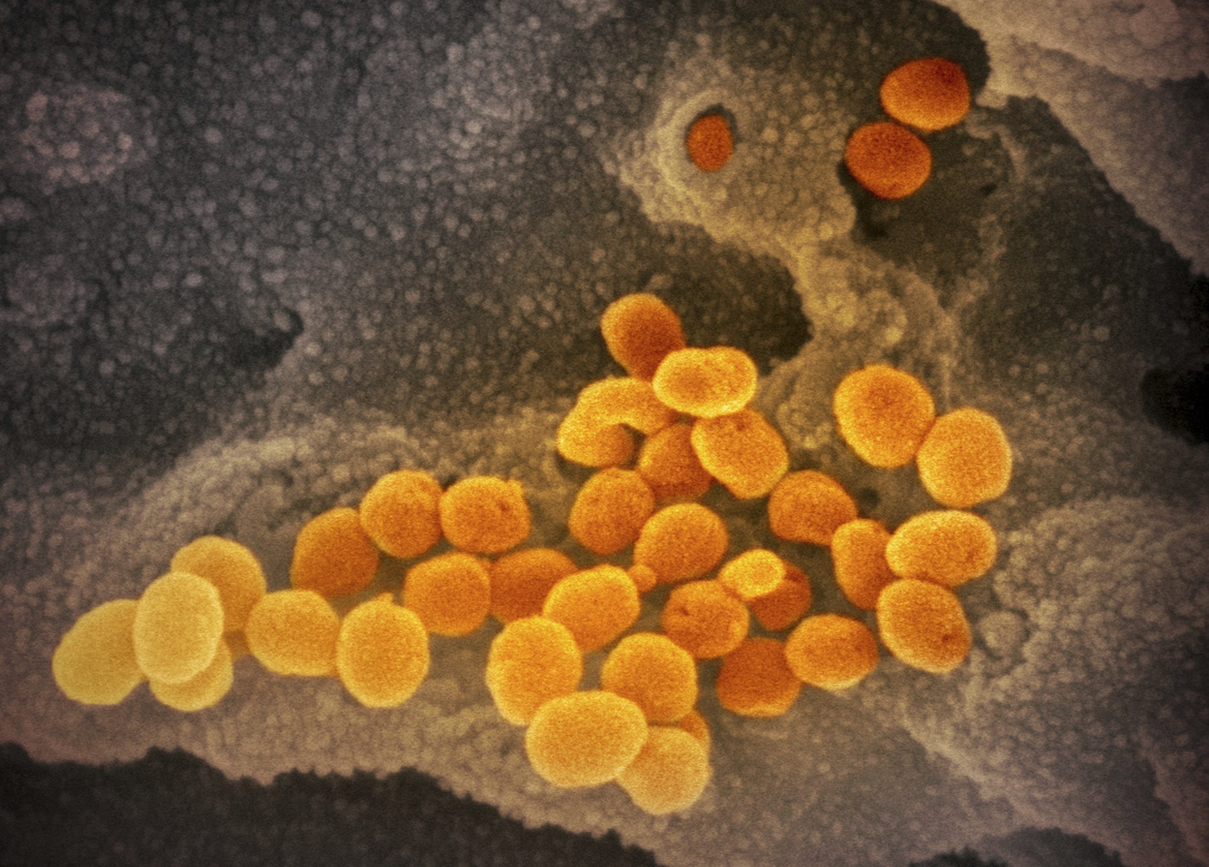 Coronavirus, nuove immagini al microscopio