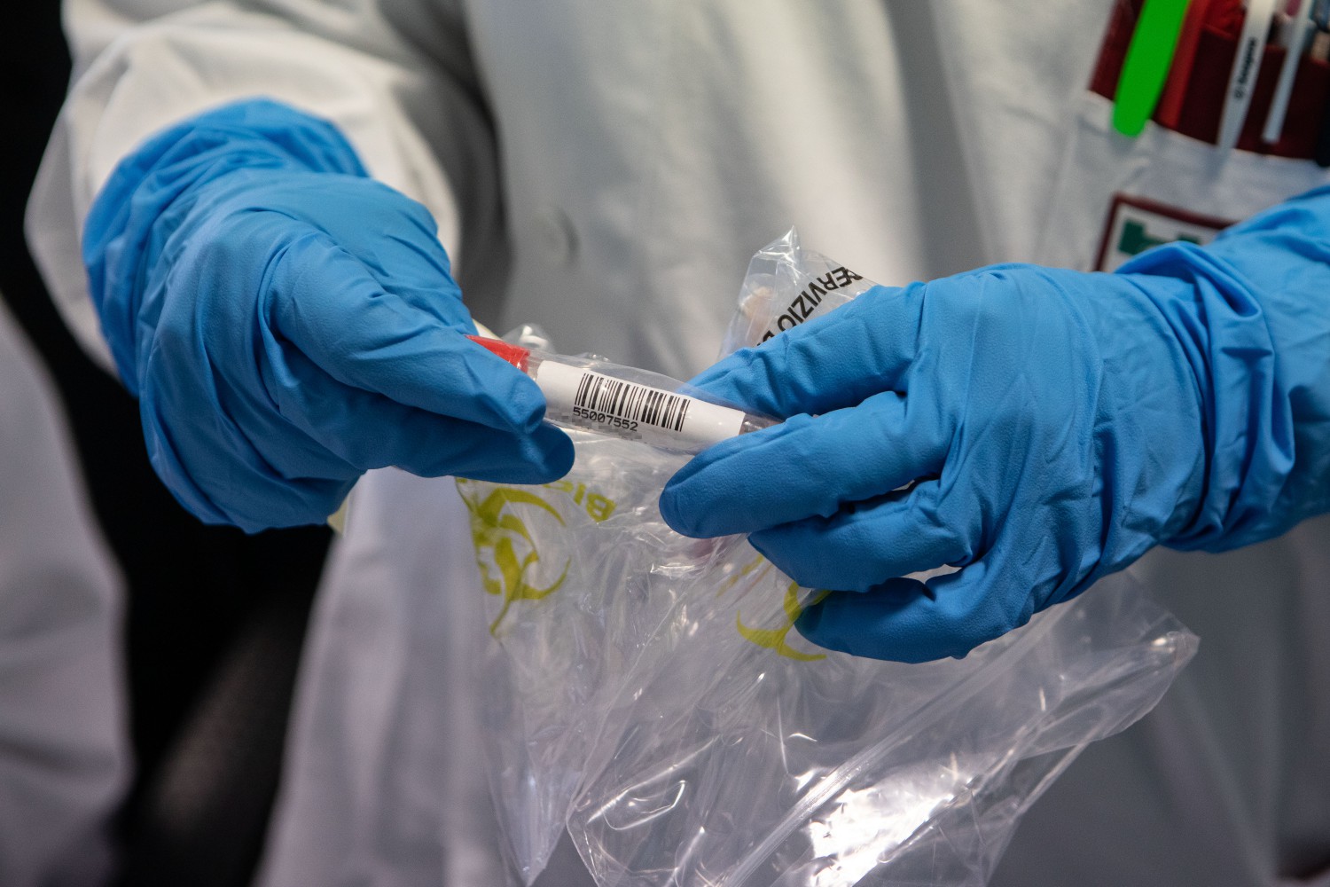 la nigeria reagisce test rapidi fatti in casa per hiv e malaria dopo il ritiro degli aiuti usa