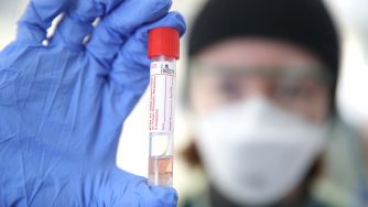 Laboratorio covid-19