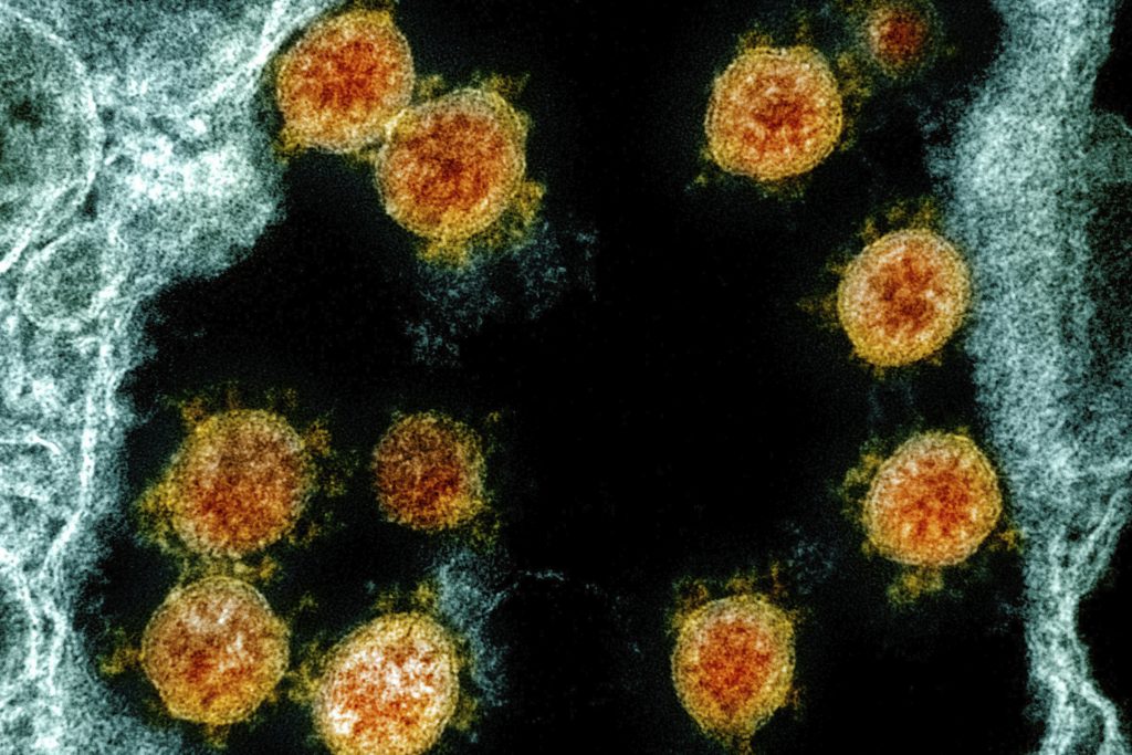 Virus al microscopio (La Presse)