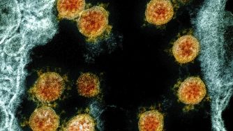 Virus al microscopio (La Presse)