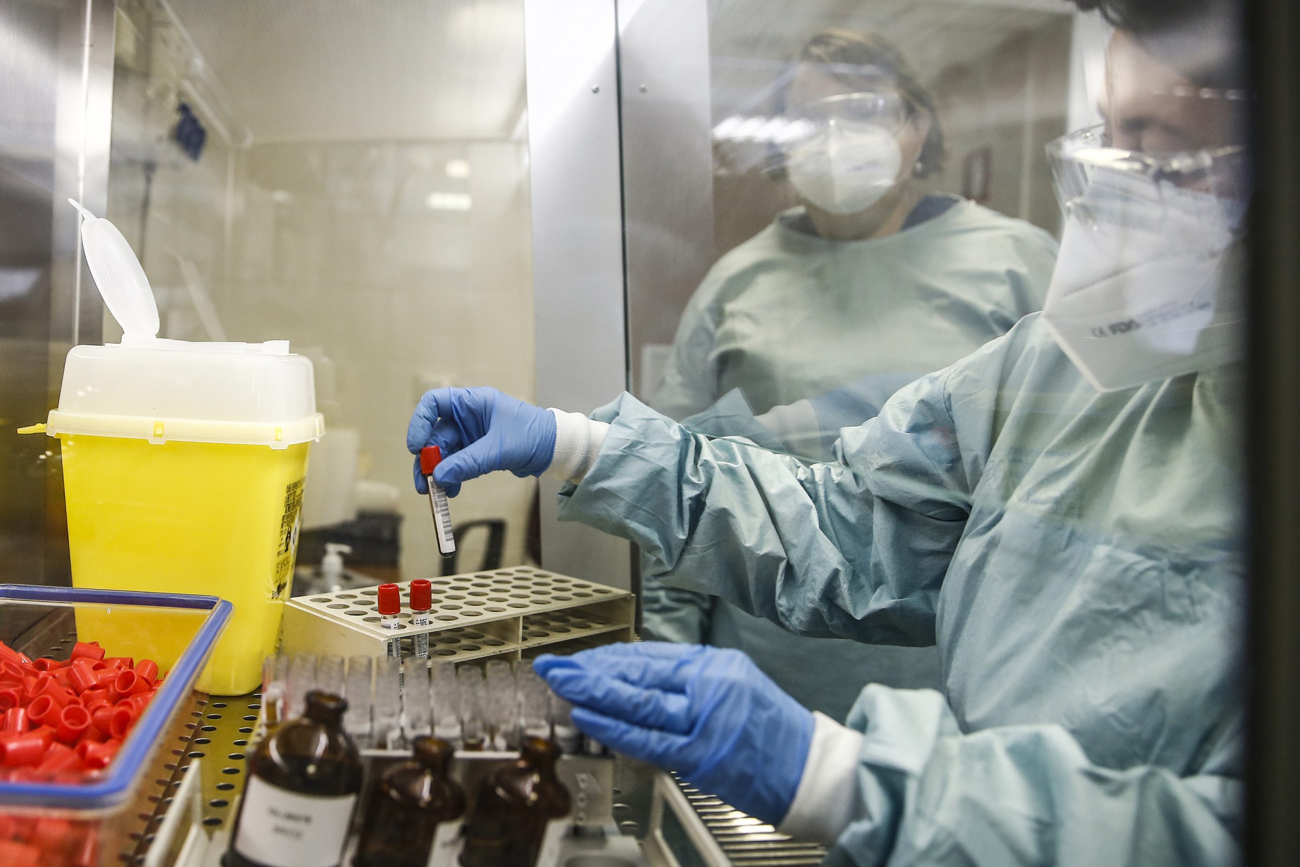 Laboratorio Coronavirus (LaPresse)